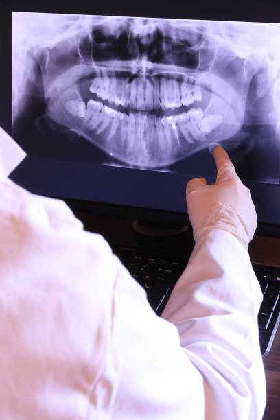 Best Emergency Dentist for Lost Fillings or Crowns in Inwood, NY
